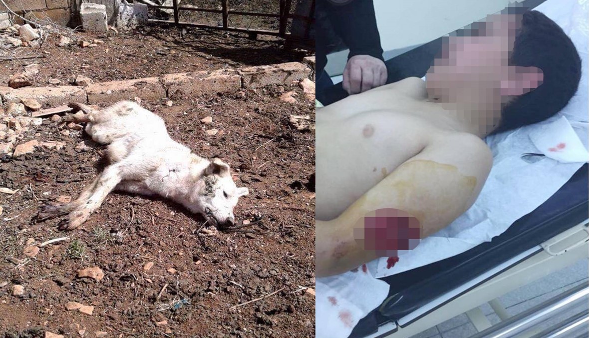 حادثة مرعبة... كلب شارد هاجم الطفل حسين ونهش جسده