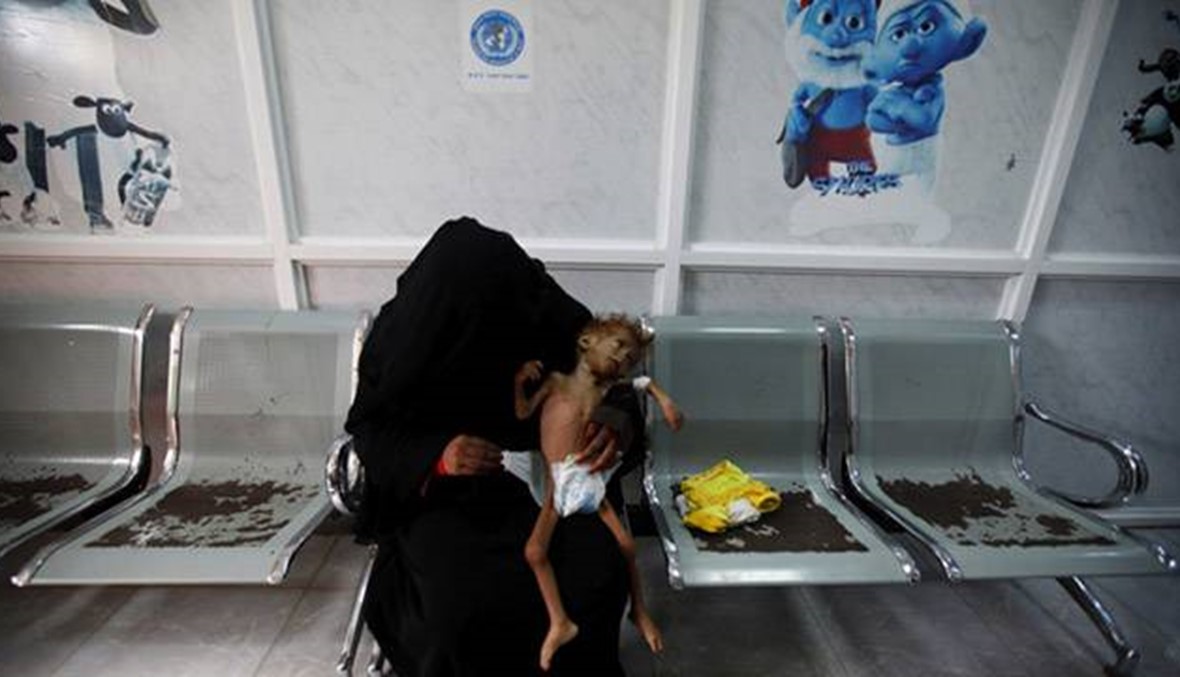 الأمم المتحدة: اليمن على حافة المجاعة \r\n8 من كل 10 أطفال يعانون سوء التغذية