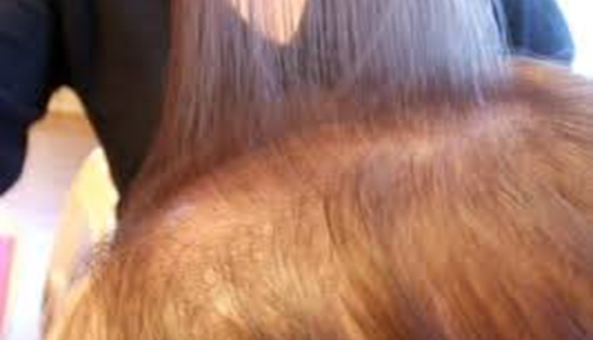 تساقط الشعر... أسبابه وعلاجه؟