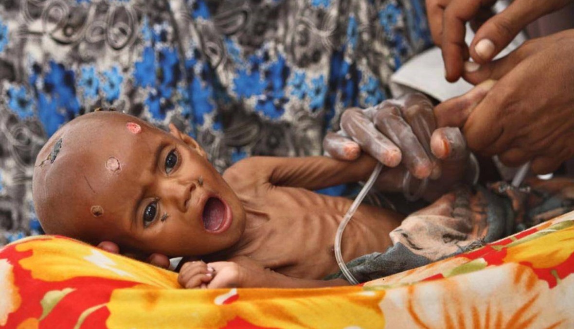 تحذير من اليونيسف: 1,4 مليون طفل مهددون بسوء تغذية حاد في الصومال
