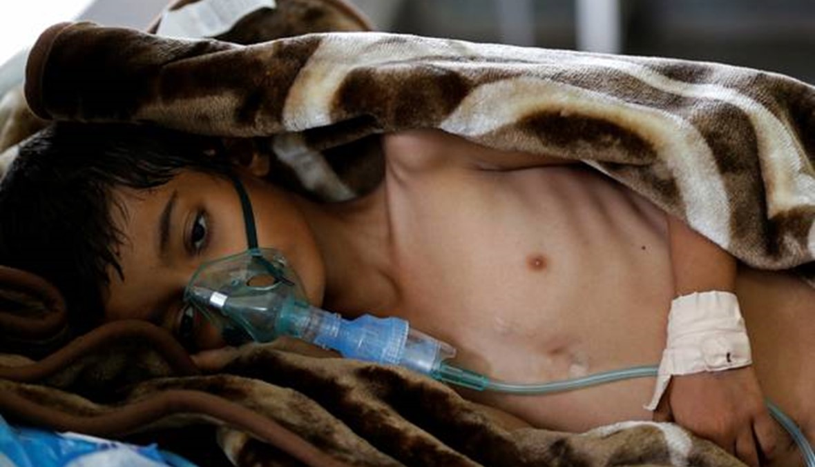 اليمن: 612 ألف إصابة بالكوليرا... "الزيادات مفاجئة وكبيرة"