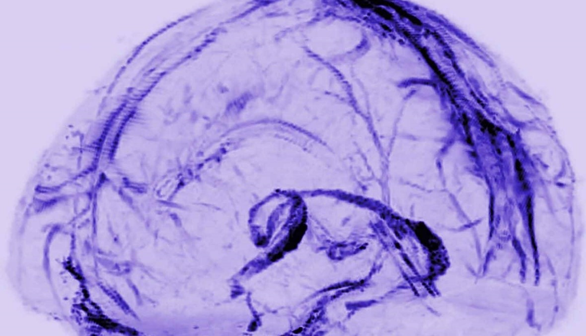 اكتشاف "أنابيب صرف" يتخلّص الدماغ عبرها من السموم