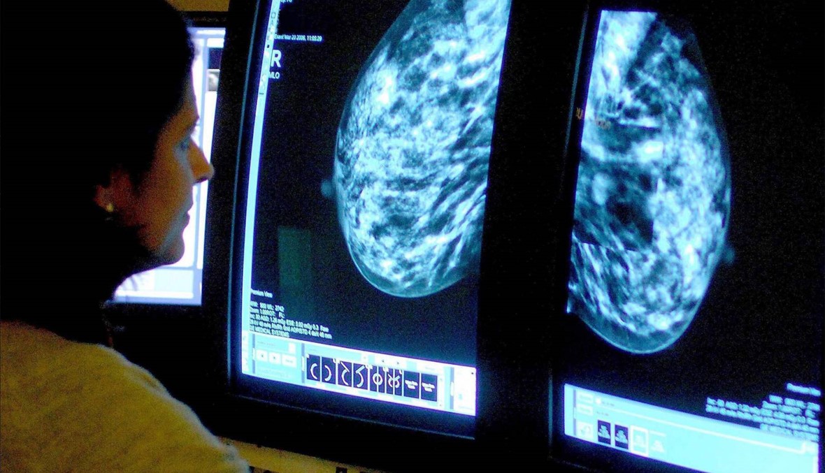 تقنية جديدة للكشف عن سرطان الثدي