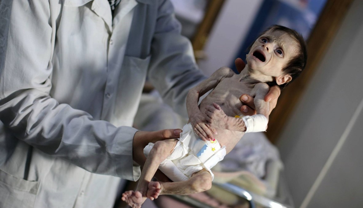 الغوطة الشرقيّة محاصرة... 1100 طفل يعانون "سوء تغذية حادًّا"