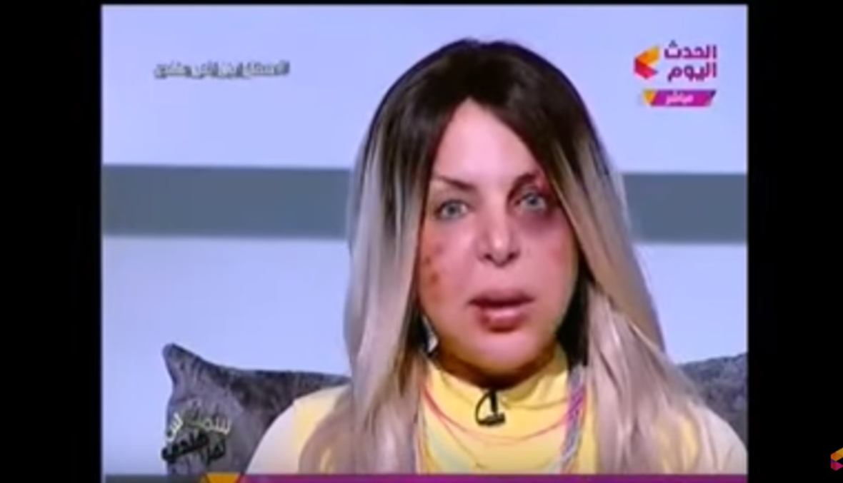 إعلامية مصرية تقصّ شعرها إلى حين الأخذ بالثأر (فيديو)
