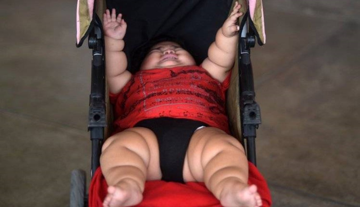 طفل يبلغ 10 أشهر وزنه 28 كيلغ... أخطر حالات البدانة!