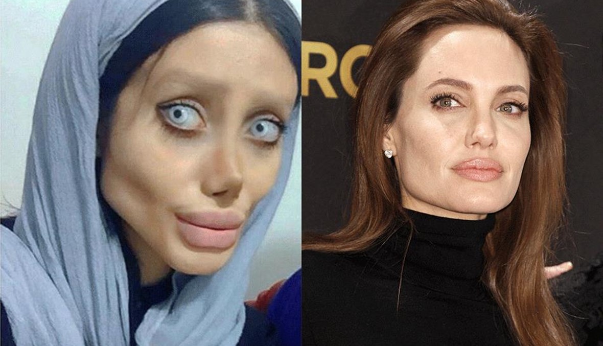 إيرانية تخضع لأكثر من 50 جراحة لتشبه أنجلينا جولي... النتائج مخيفة! (صور)
