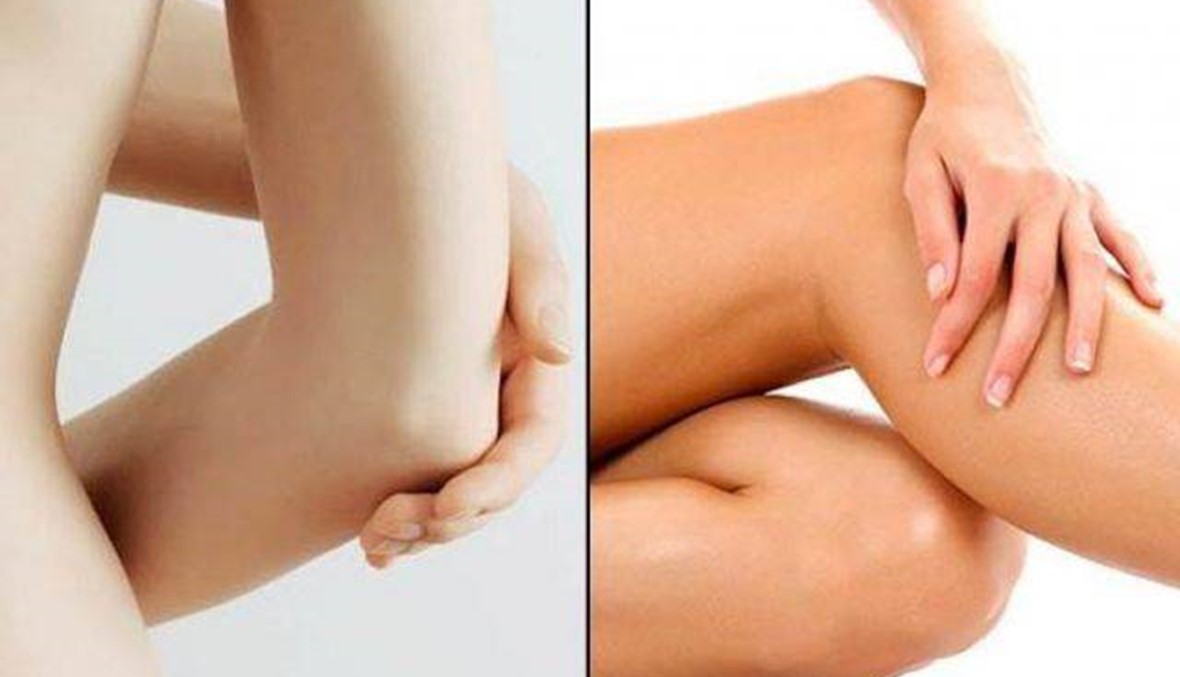 تخلصي بسهولة من اسمرار الكوع والركبة
