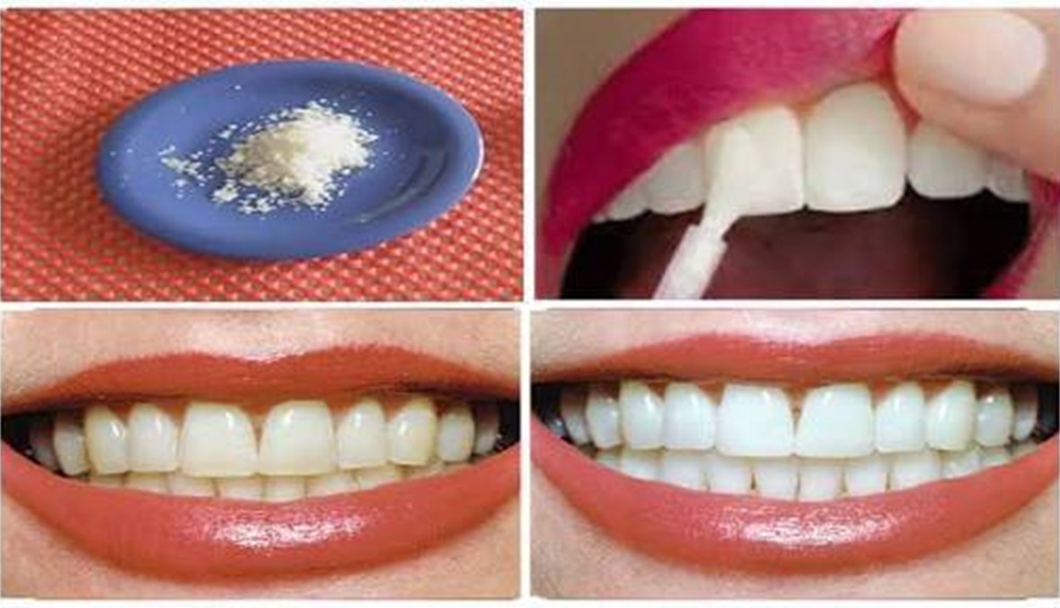لن تصدق فوائد الملح لأسنانك