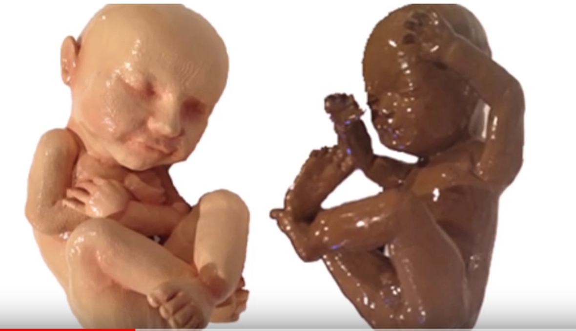 بالفيديو: أصبح بإمكانك حضن جنينك قبل أن يولد