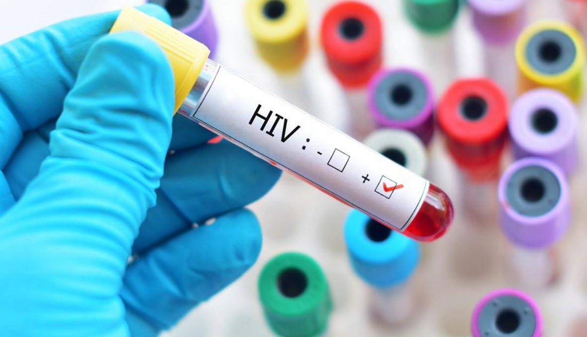 أمل جديد : التوصل الى "علاج وظيفي" لفيروس HIV