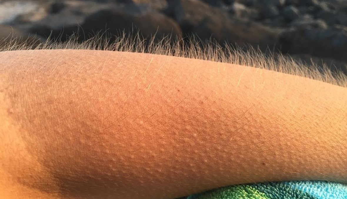 ما هي القشعريرة ولماذا نشعر بها؟