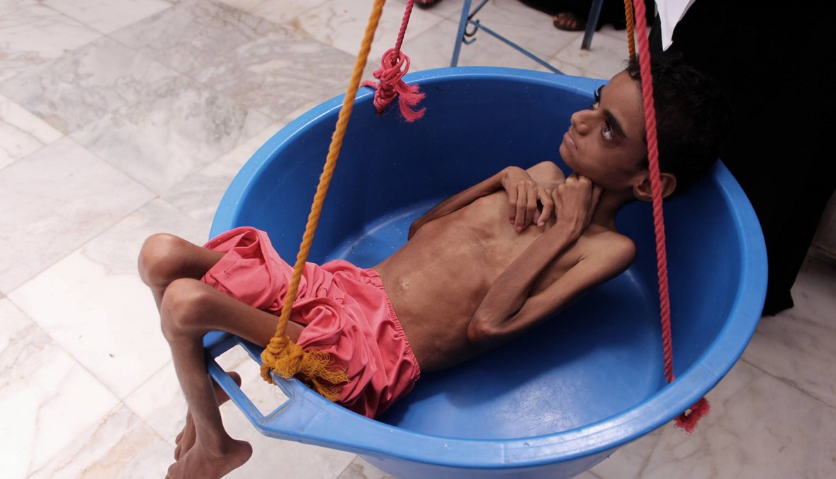 أطفال يمنيّون يتألّمون من شدّة الجوع: "الحياة أصبحت صعبة جدًّا"