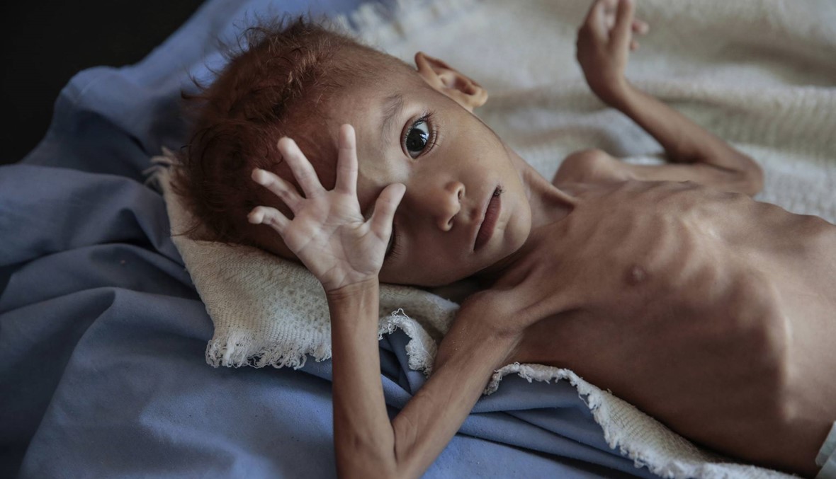 تحذير أممي... الأزمة الإنسانية في اليمن ستتفاقم السنة المقبلة