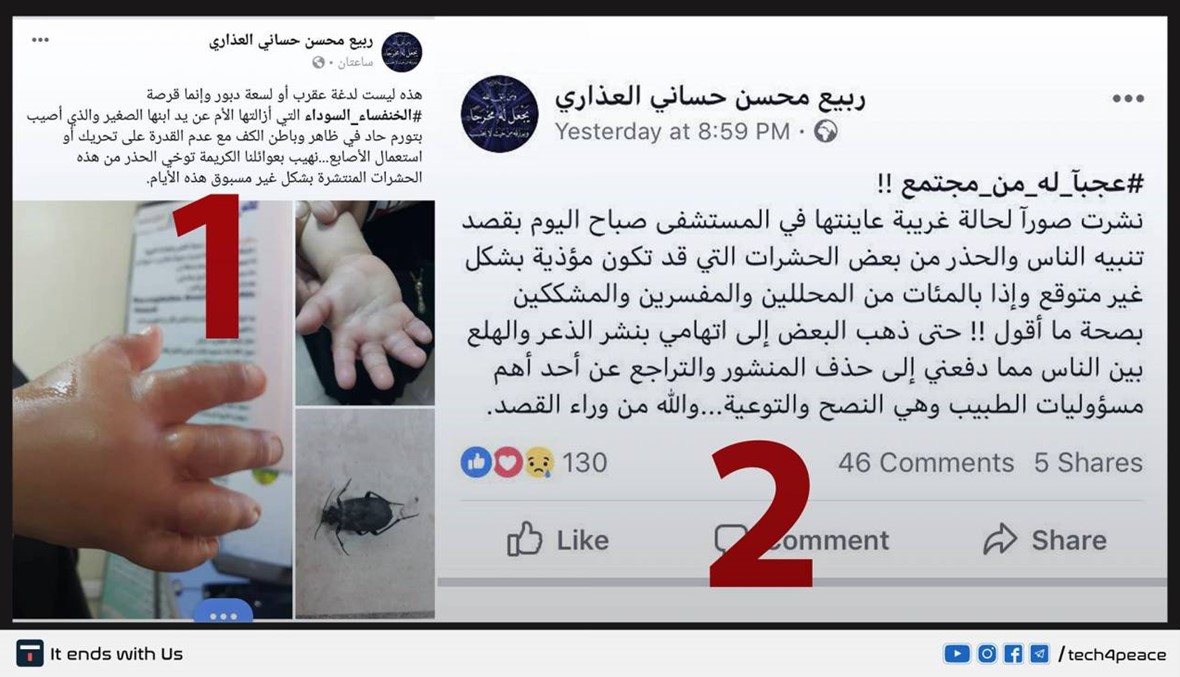 يد تورّمت... "هذه قرصة خنفساء سوداء": صور مع تحذير، وإليكم التّفاصيل