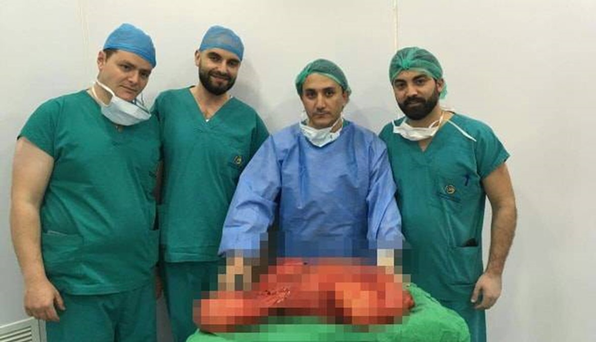 انجاز طبي في مستشفى سيدة المعونات: استئصال ورم يزن ١٥ كيلوغراماً