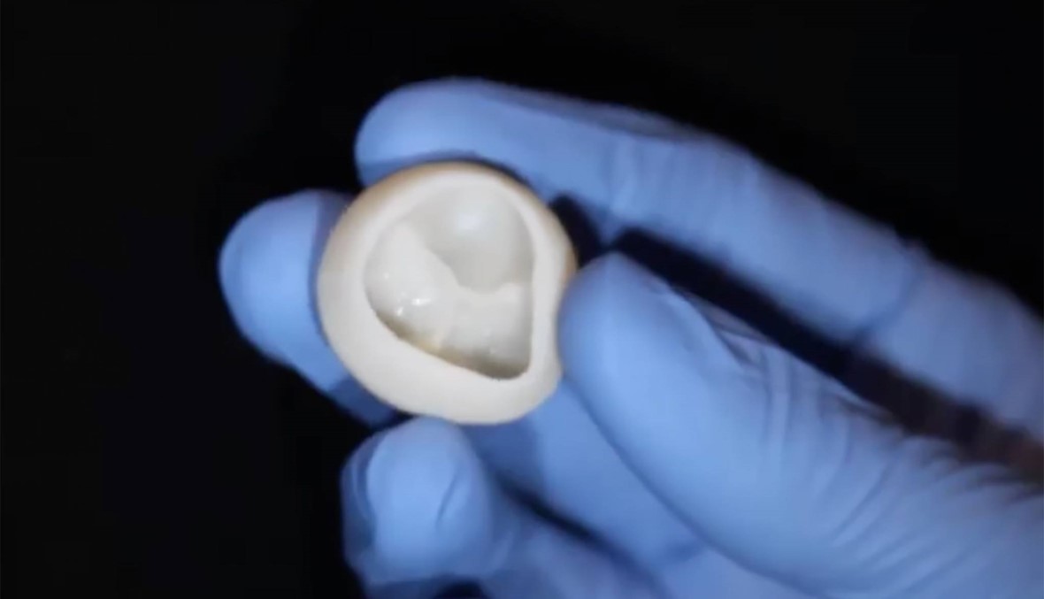 انجاز أميركي: صنع صمام قلب من الكولاجين باستخدام الطابعة الثلاثية الأبعاد