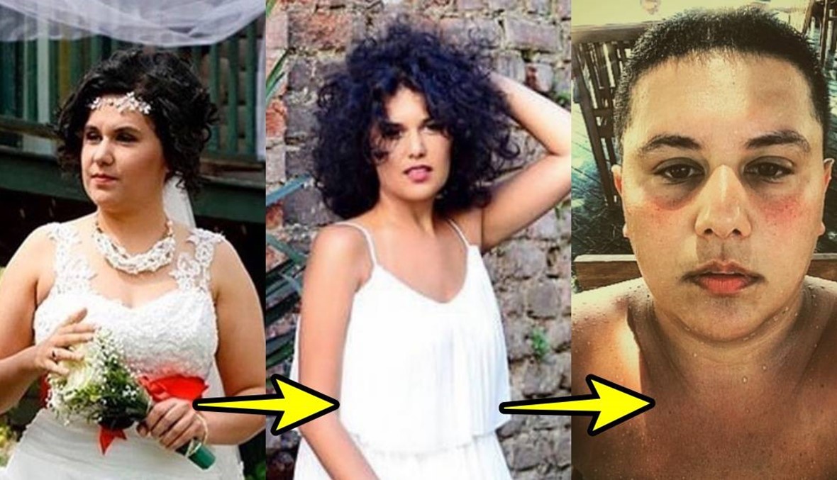 ممثلة تركية تعلن تحوّلها جنسياً... أطلقت على نفسها أطلس كاران