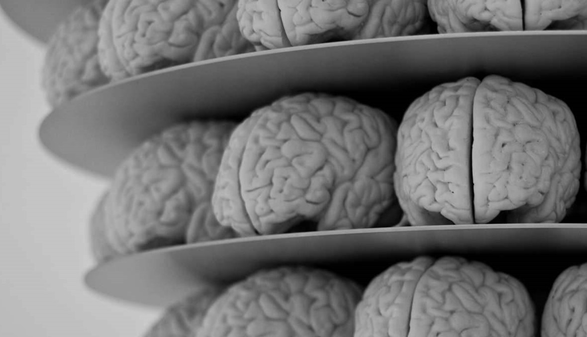 علماء فرنسيون يطوّرون جهاز أشعة ضخماً يكشف أمراض الدماغ