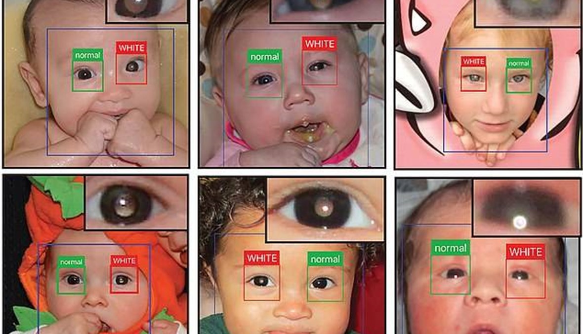 هذا التطبيق الذكي يمكنه اكتشاف اضطرابات العيون التي قد تصيب أطفالكم