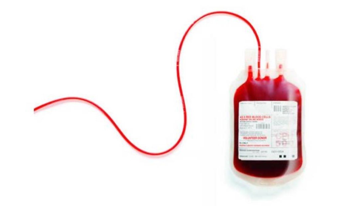 بحاجة ماسّة لبلاكات من الدم A+ في مستشفى أوتيل ديو، للاتصال 03662791