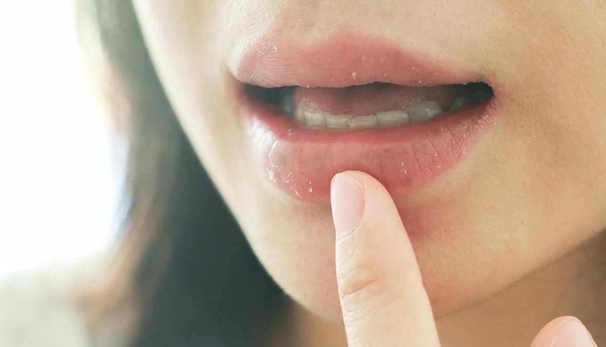 5 نصائح و5 منتجات لنقول وداعاً للشفاه الجافّة