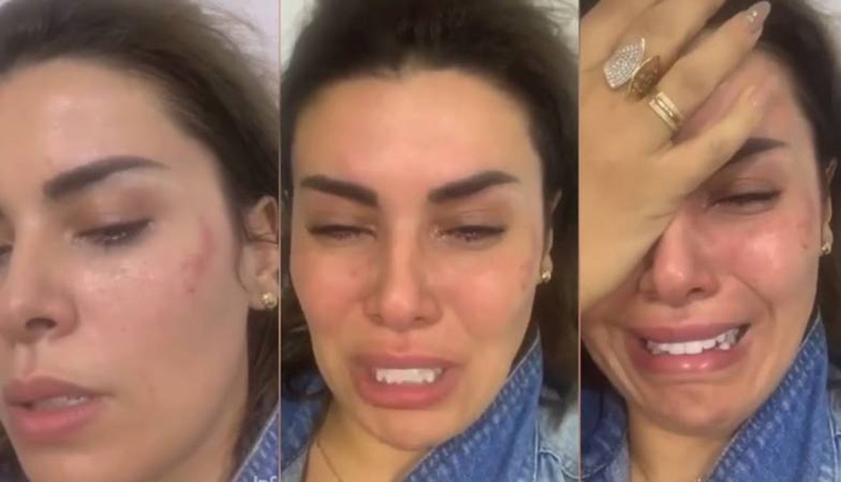 نجمة "ستار أكاديمي" أماني السويسي تتعرّض للضرب من متعهّد حفلات (فيديو)