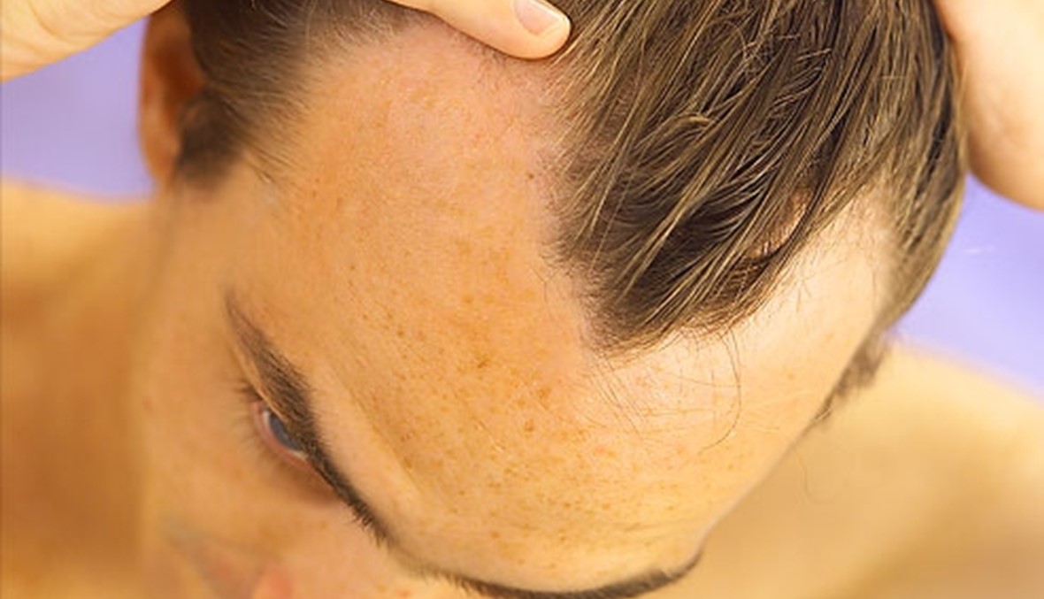 ما يجهله الرجال عن تساقط الشعر...\r\n