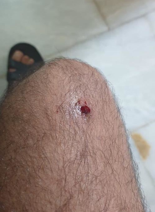 سقوط عدد من الجرحى أثناء تشييع جثامين شهداء الجيش (صور)