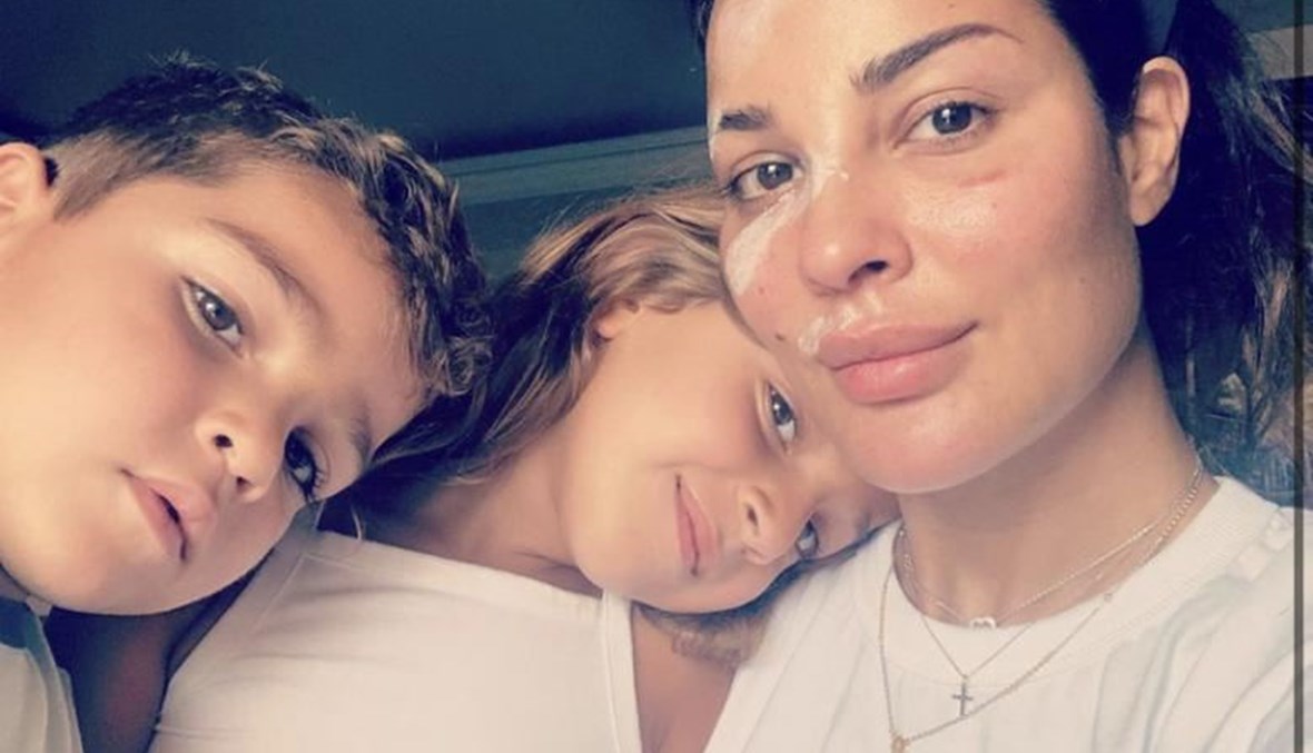 نادين نجيم ولحظة الانفجار: الله صنع معجزة!