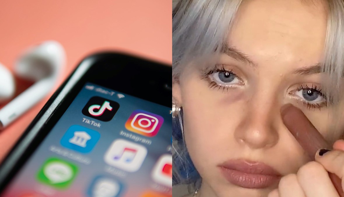 هل تصدّقون أنّ الهالات السوداء أصبحت من أبرز الاتجاهات؟