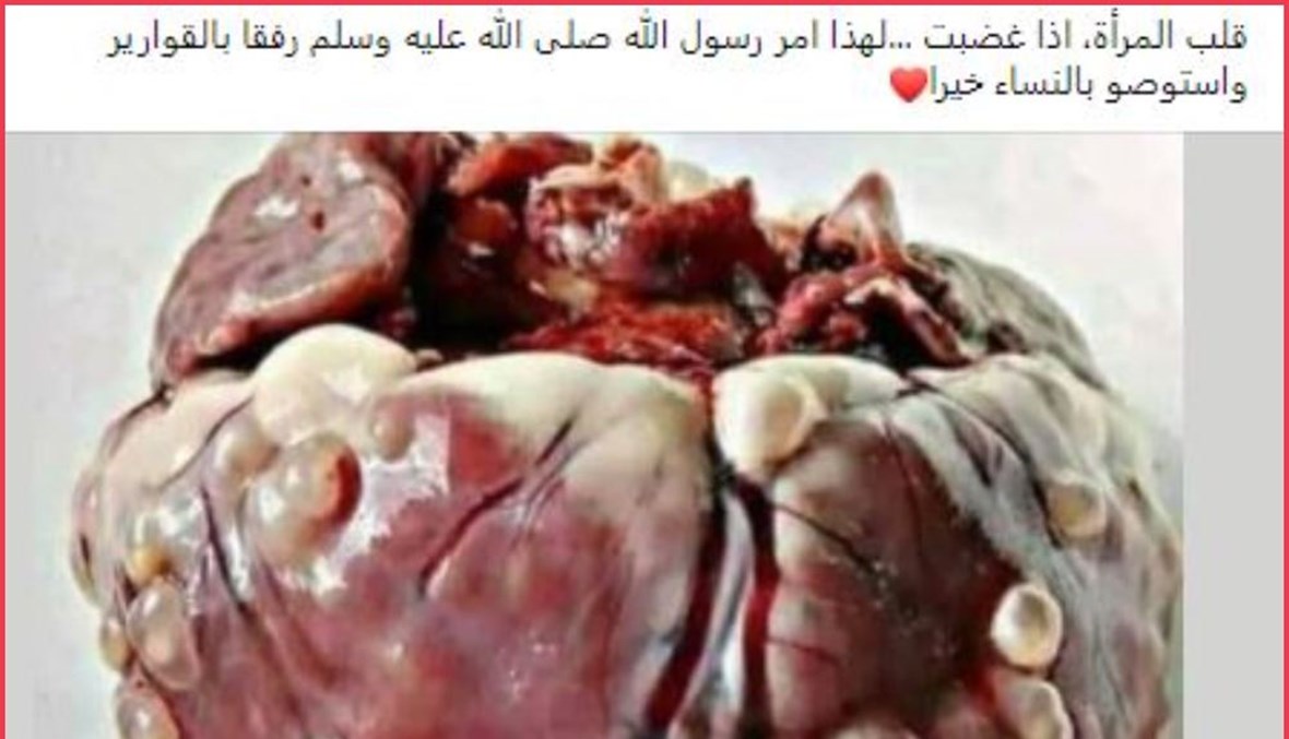 صورة لـ"قلب المرأة عندما تغضب"؟ إليكم الحقيقة FactCheck#