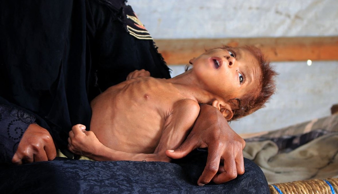 الطفل اليمني مشعل محمد (4 أعوام) الذي يعاني سوء تعذية حادا، تحمله والدته داخل كوخ في مخيم للنازحين في محافظة حجة شمال اليمن (2 آذار 2021، أ ف ب). 