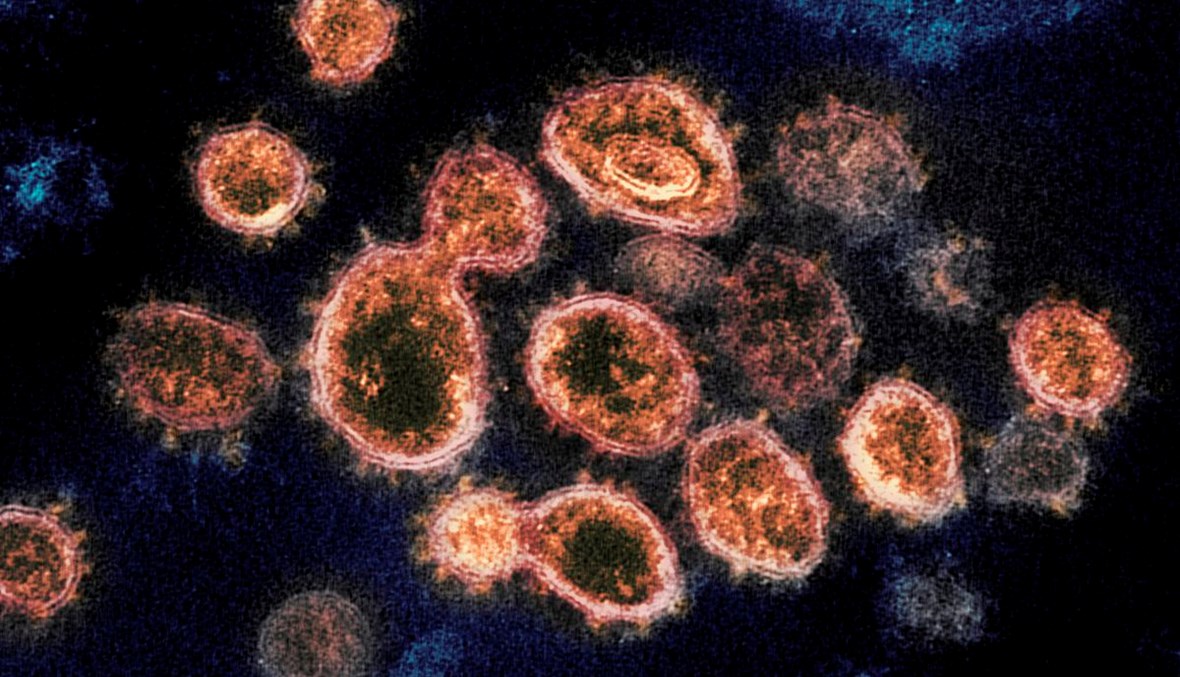 مجهر المعهد الوطني للحساسية والأمراض المعدية يظهر فيروسات "كوفيد-19" - "أ ب"
