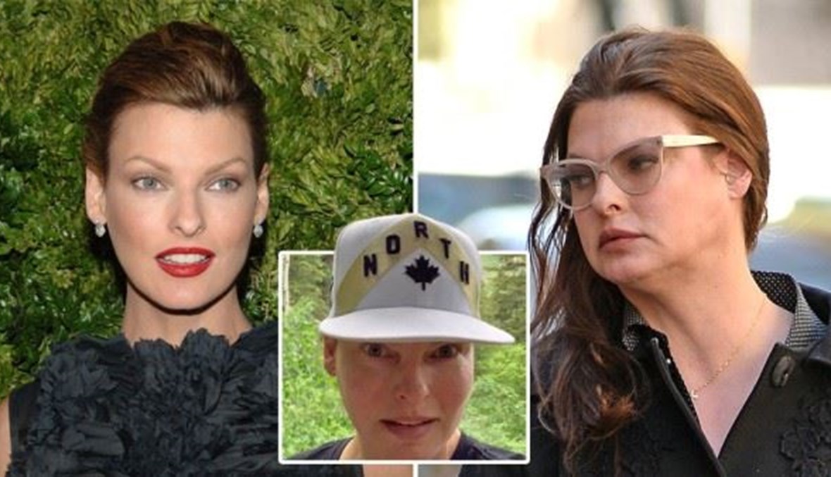 "لقد تمّ تشويهي"... ليندا إيفانجليستا في حرب ضدّ تحلّل الدهون بالتبريد "CoolSculpting"