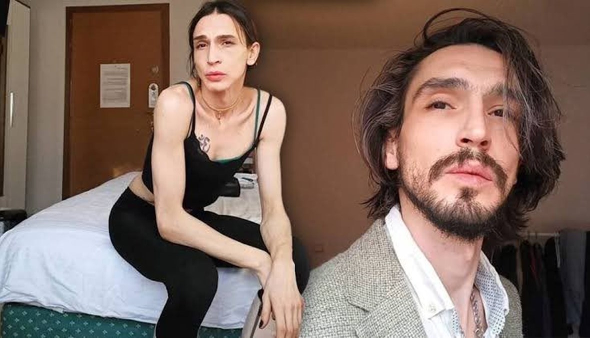 أحد أبطال مسلسل "الحفرة" يجري عملية تغيير جنس: مقتنع بشكلي