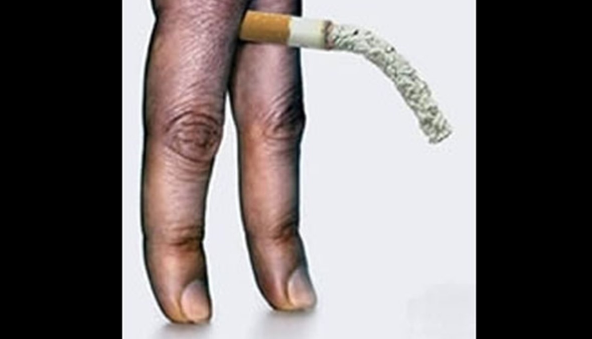 هل يحدّ التدخين من حجم القضيب المنتصب؟