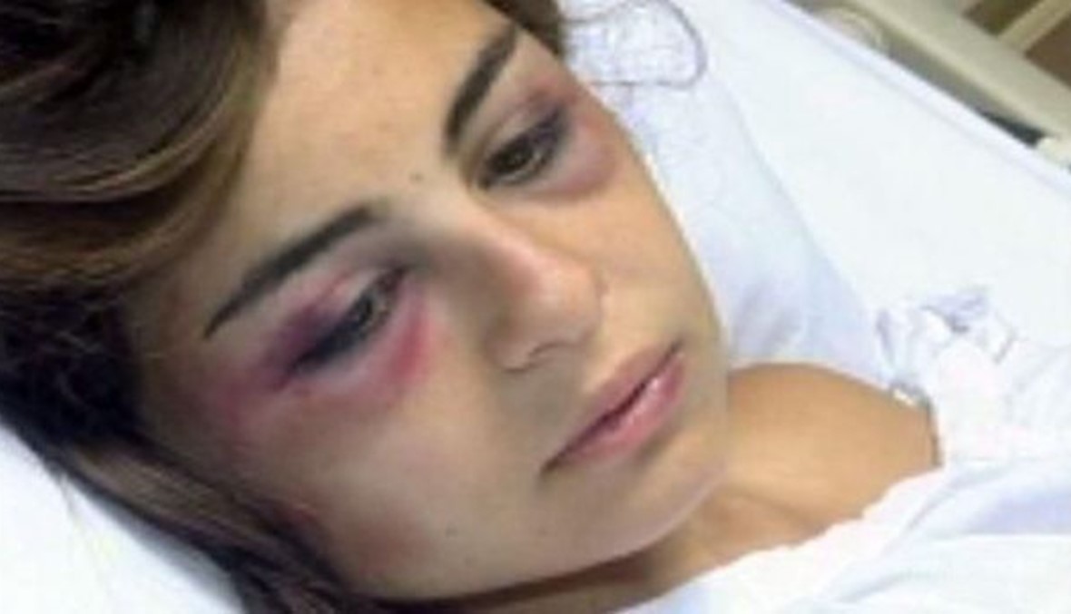 زوج تمارا حريصي نال العقاب وهو...